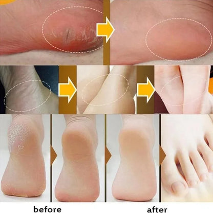 Herbal Anti Crack Foot Cream Spray Heel Cracking Repair Products Exfoliation Dead Skin Removal Softening Moisturize Smooth Care