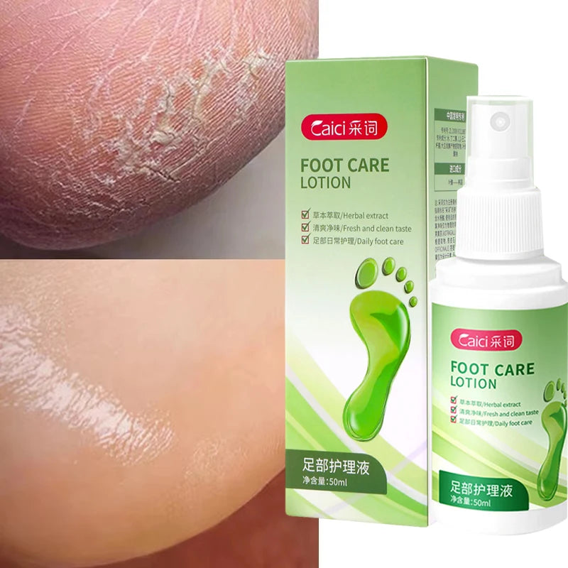 Herbal Anti Crack Foot Cream Spray Heel Cracking Repair Products Exfoliation Dead Skin Removal Softening Moisturize Smooth Care