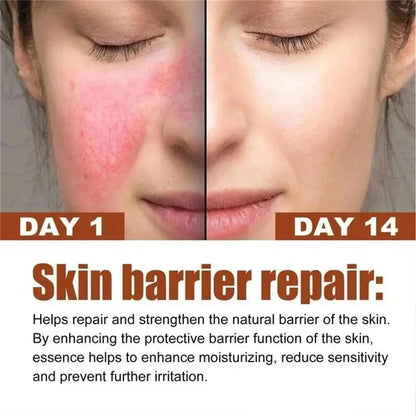 Facial Redness Repair Capsule Oil Improve Sensitive Skin Dryness Moisturizer Soothing Serum Removal Rosacea Korean Cosmetics
