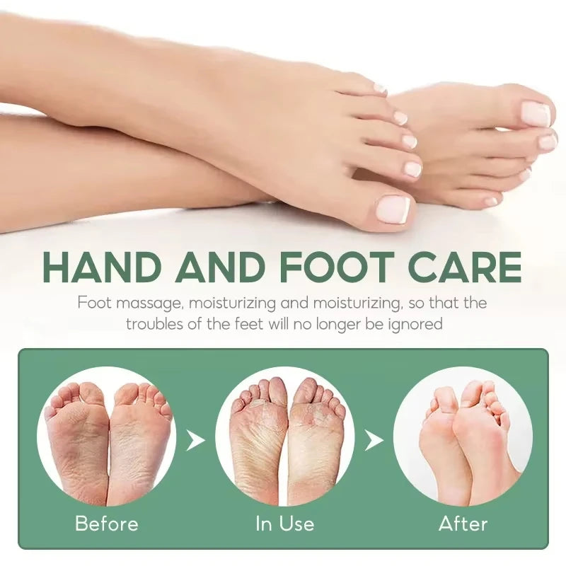 Herbal Anti Crack Foot Cream Spray Heel Cracking Repair Products Exfoliation Dead Skin Removal Softening Moisturize Smooth Care
