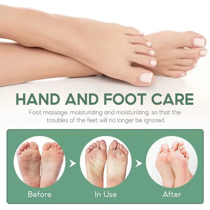 Herbal Anti Crack Foot Cream Spray Heel Cracking Repair Products Exfoliation Dead Skin Removal Softening Moisturize Smooth Care