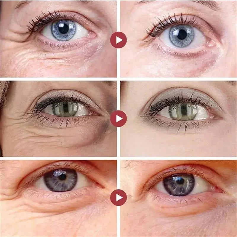 Snail Eye Cream Stick Collagen Fade Fine Lines Wrinkle Lightening Dark Circles Firming Eye Bags Puffiness Moisturizing Eye Cream