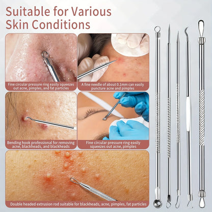12pcs Blackhead Tools,Pimple Popper Tool Kit, Quick and Easy of and Blackheads,Precise Eyebrow Tweezers for Facial Hair women