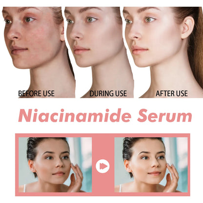 Niacinamide Serum 30ml Brightening Pore Minimizer Fade Dark Spots Hydrating Even Skin Tone Anti Aging Face Serum Non Irritating