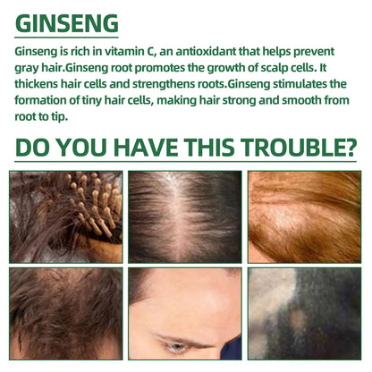 Ouhoe Ginseng Hair Growth Serum 100ml Nourish Scalp Bioactive Formula Promote Hair Regrowth Reduce Hair Fall Strengthen Roots