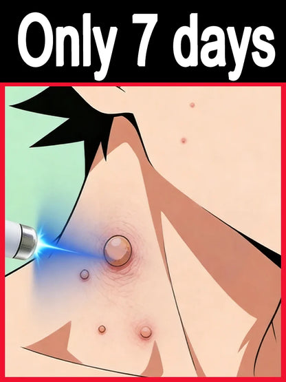 ᴸᵃˢᵉʳ ᵖᵉⁿ ᵃᶜᶜᵘʳᵃᵗᵉˡʸ ʳᵉᵐᵒᵛᵉˢ warts without scarring or recurrence