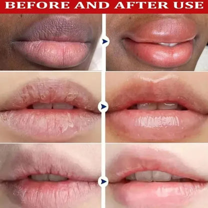 Fast Remove Dark Lip Balm Lighten Melanin Lip Mask Exfoliating Fade Lip Lines Dead Skin Moisturizing Brighten Repair Lip Care