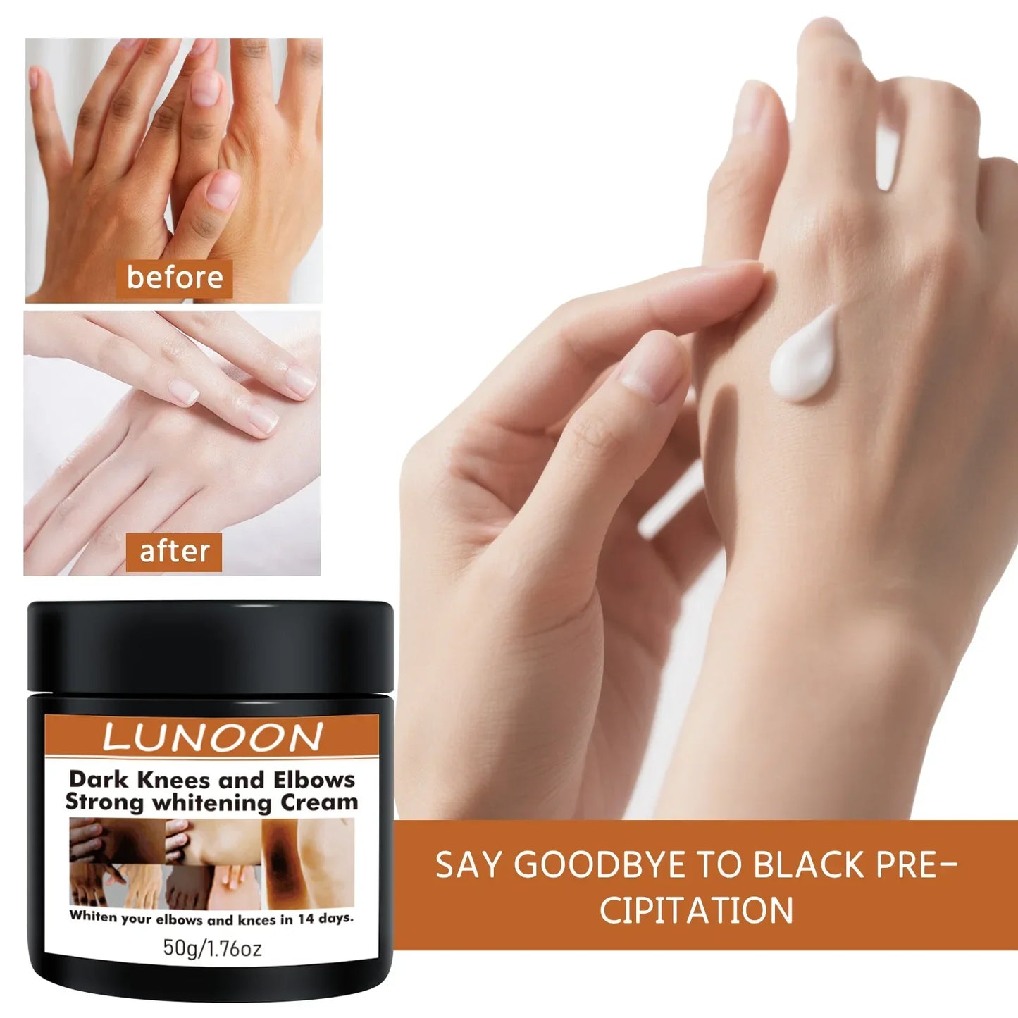 Dark Knuckle Wh-itening Cream Brighten Moisturizing Remover Pigmentation Brightening Knees Skin Care Bleaching Cream