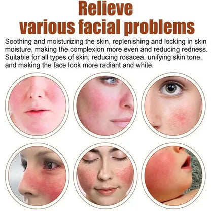 Facial Redness Repair Capsule Oil Improve Sensitive Skin Dryness Moisturizer Soothing Serum Removal Rosacea Korean Cosmetics