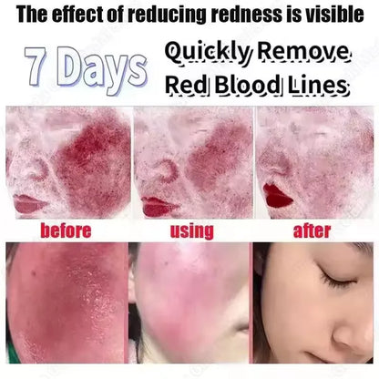 Facial Redness Repair Capsule Oil Improve Sensitive Skin Dryness Moisturizer Soothing Serum Removal Rosacea Korean Cosmetics