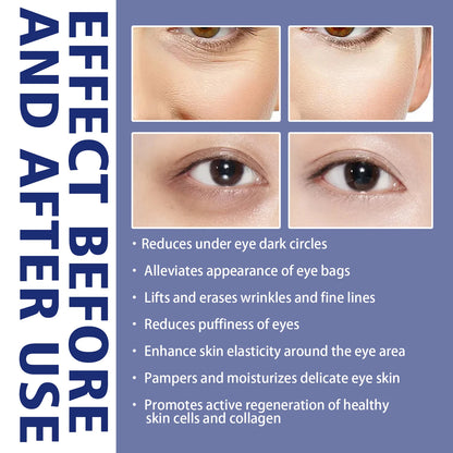 Anti Aging Eye Cream with Hyaluronic Acid Fade Fine Lines Remove Dark Circles Puffiness Moisturizing And Firming for Eye Bags