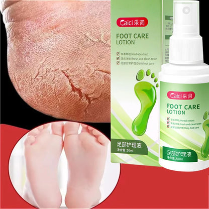 Herbal Anti Crack Foot Cream Spray Heel Cracking Repair Products Exfoliation Dead Skin Removal Softening Moisturize Smooth Care