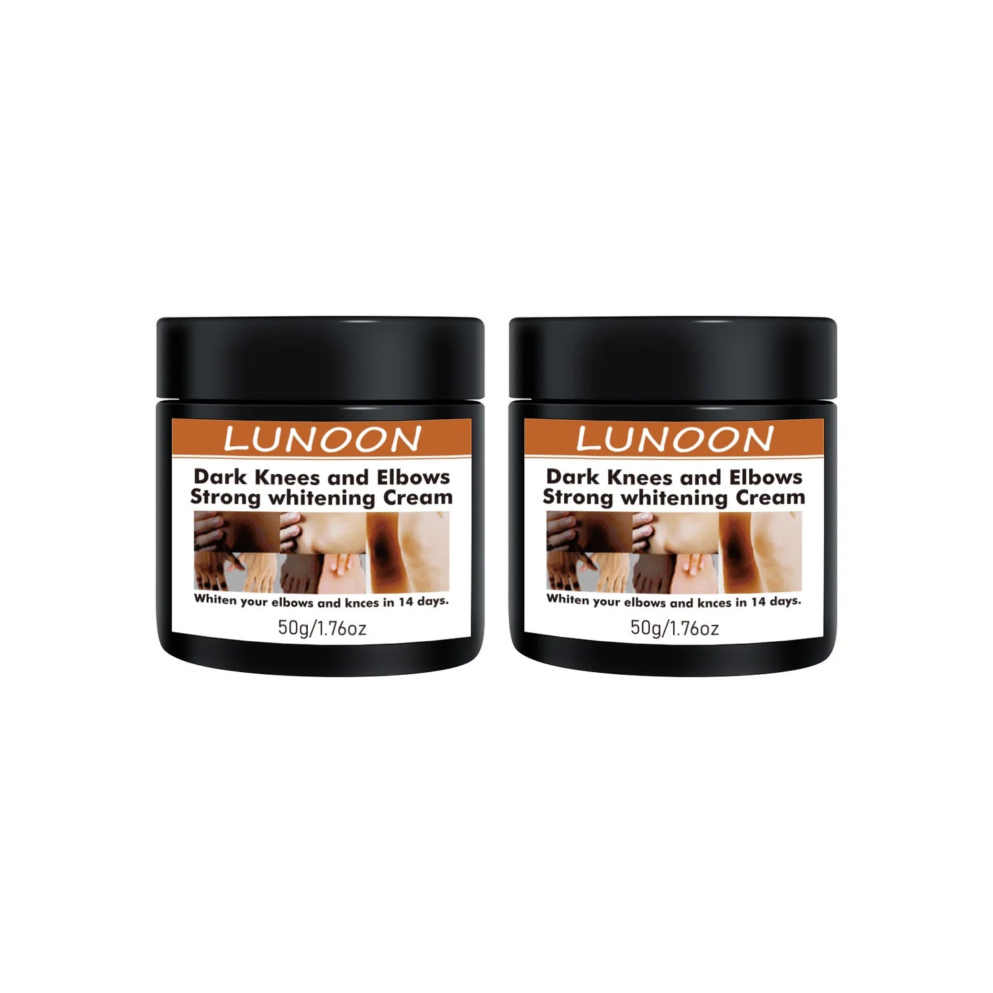 Dark Knuckle Wh-itening Cream Brighten Moisturizing Remover Pigmentation Brightening Knees Skin Care Bleaching Cream
