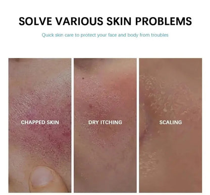 Repair Facial Redness Cream Instant Spider Vein Remove Sensitive Skin Sooth Anti Redness Rosacea Treat Lotion Korean Cosmetics