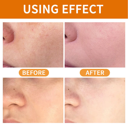 Orange Exfoliating Gel For Facial Body Gentle Orange Facial Scrub Body Cleansing Gel Dead Skin Remover Scrub Skin Cleaning