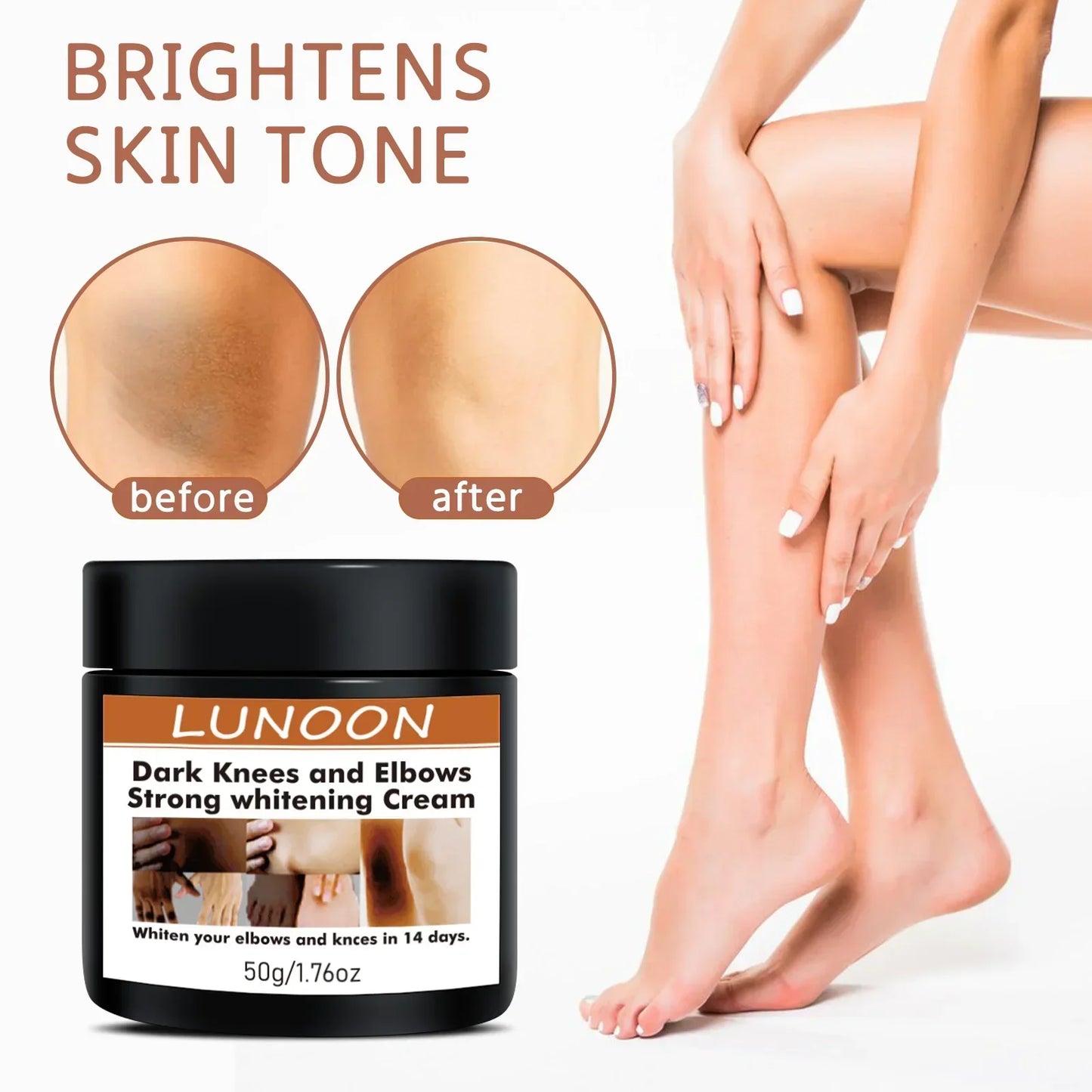 Dark Knuckle Wh-itening Cream Brighten Moisturizing Remover Pigmentation Brightening Knees Skin Care Bleaching Cream
