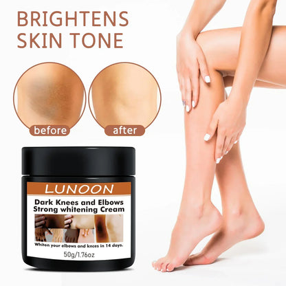Dark Knuckle Wh-itening Cream Brighten Moisturizing Remover Pigmentation Brightening Knees Skin Care Bleaching Cream