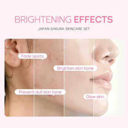 Sakura Skin Care Sets & Kits With Cleanser,Serum,Eye Cream,essence Cream Beauty Products For Women Face Skin Care Set