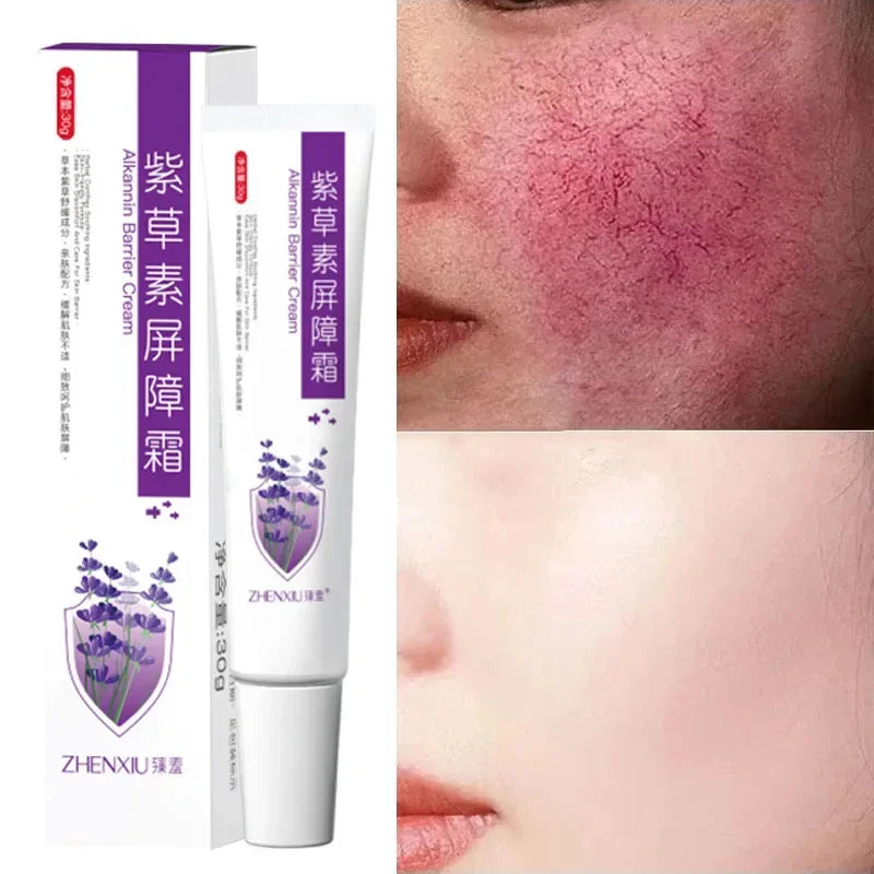Repair Facial Redness Cream Instant Spider Vein Remove Sensitive Skin Sooth Anti Redness Rosacea Treat Lotion Korean Cosmetics