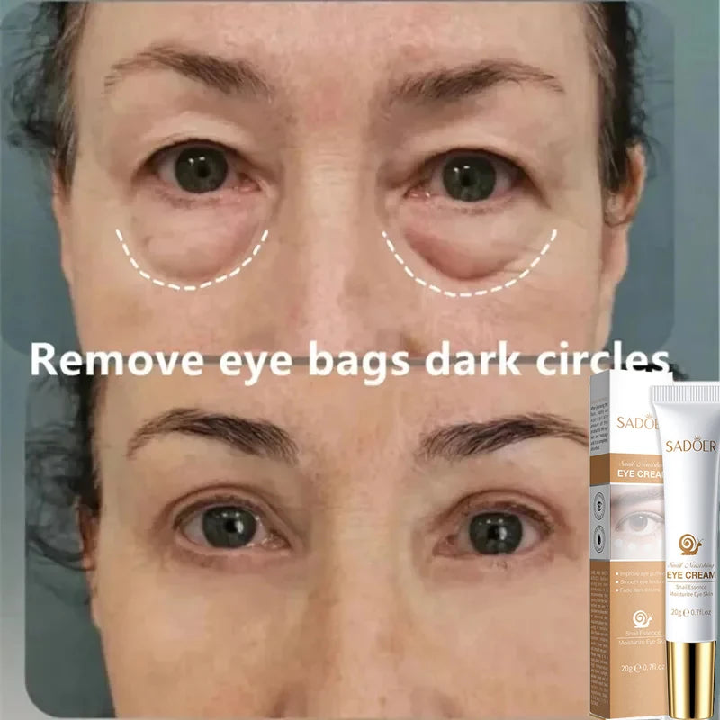 Instant Eye Bag Removal Cream Collagen Removal Wrinkles Lifting Fade Fine Lines Moisturizing Brightening Anti Puffiness Eye Care