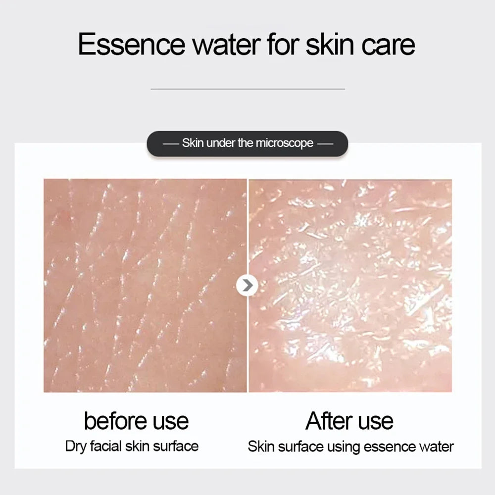 a 500ml  Large Capacity Essence Water Niacinamide Improve Dull Hyaluronic Acid Moisturize Dry Skin Facial Beauty Care Toner