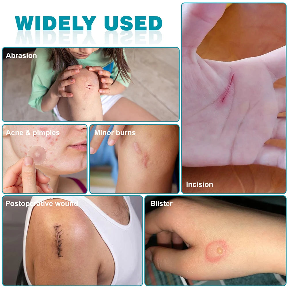 Hydrocolloid Roll Self-Adhesive Hydrocolloid Patch Bandage For Wound Care Bed Sore Bandages Hydrocolloid Gel Waterproof Patches