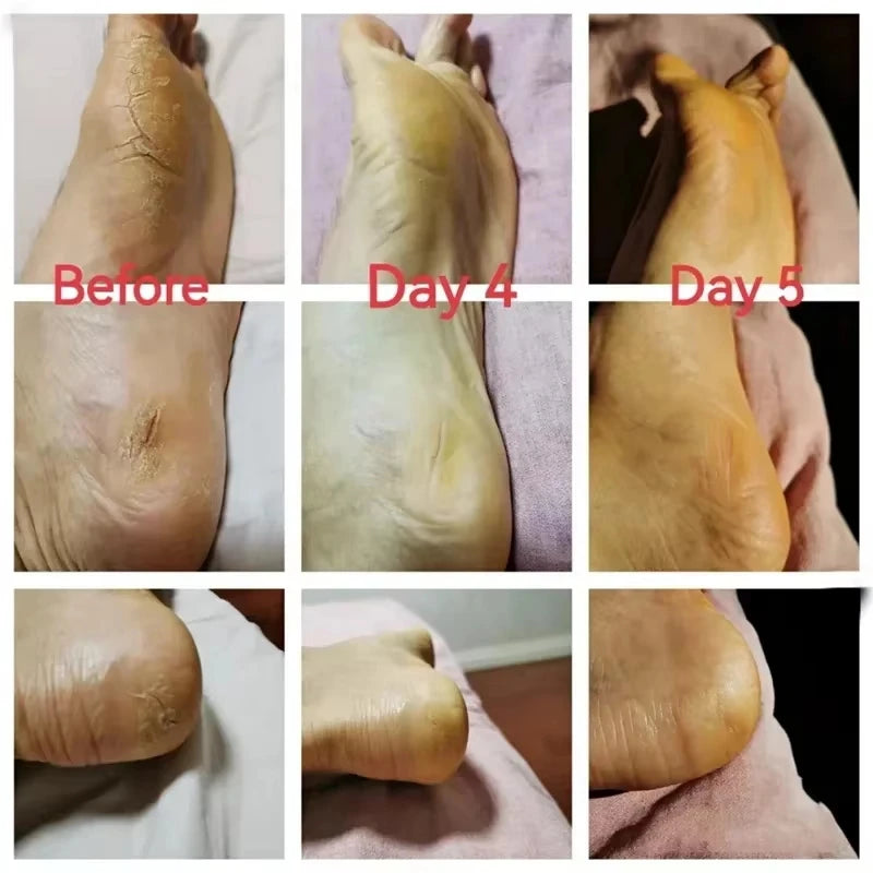 Herbal Anti Crack Foot Cream Spray Heel Cracking Repair Products Exfoliation Dead Skin Removal Softening Moisturize Smooth Care