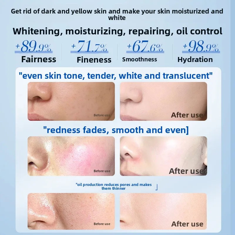OHBT Camellia Face Cream, Plant Whitening Anti-wrinkle Moisturizing Facial Cream, Antioxidant Brightening Essence Cream 50g