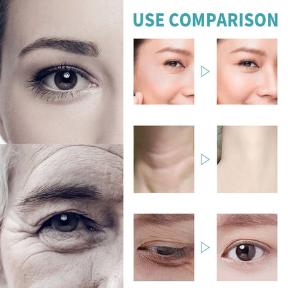 5 Seconds Instant Remove Wrinkles Cream Retinol Anti Aging Firming Moisturizing Tightens Improves Edema Facial Skincare Cream