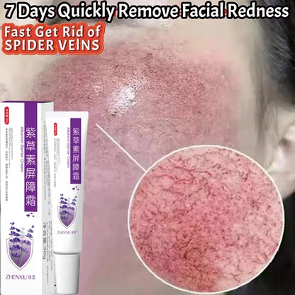 Repair Facial Redness Cream Instant Spider Vein Remove Sensitive Skin Sooth Anti Redness Rosacea Treat Lotion Korean Cosmetics