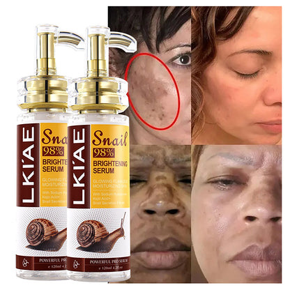 AILKE Snail Extract Whitening Serum, Moisturizing, Reduce Dark Spots, Wrinkle, Even Skin Tone, Lightening Essence for Face, Body