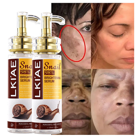 AILKE Snail Extract Whitening Serum, Moisturizing, Reduce Dark Spots, Wrinkle, Even Skin Tone, Lightening Essence for Face, Body