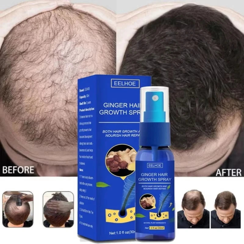 Ginger Hair Growth Serum Spray Anti Loss Regrowth Hair Growth Oil Essence Scalp Massage Moisturizing Nourish Hair Care Men Women