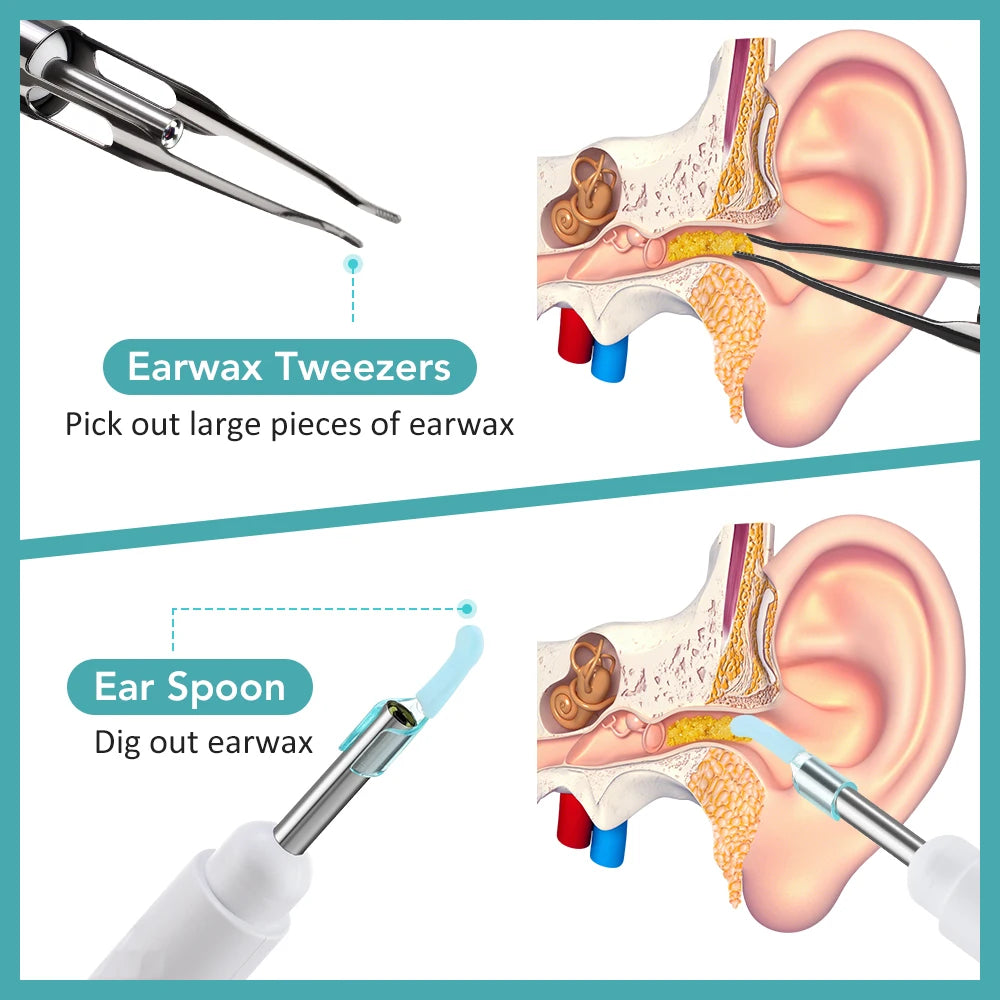 Smart Visual Ear Camera Set HD 1080P with WiFi Ear Pick Endoscope Ear Cleaner with Tweezers Ear Wax Removal Tool Ear Spoon Case