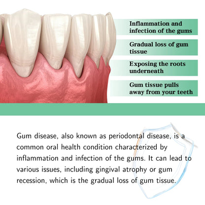 Gingival Repair Drops Quickly Repair of Cavities Caries Teeth Whiten Remove Yellow Plaque Stains Relieve Gums Decay Toothpaste