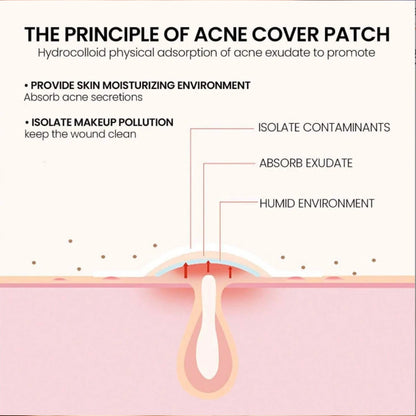 200PCS Star Facial Acne Patch Water Colloidal Acne Patch Multiple Sizes Absorbent Coverage Acne Patch, Gentle Skincare