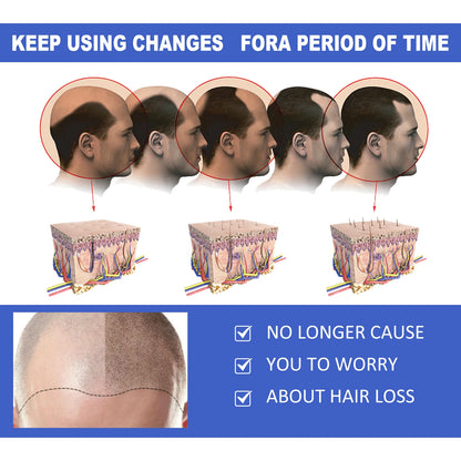 Ginger Hair Growth Serum Spray Anti Loss Regrowth Hair Growth Oil Essence Scalp Massage Moisturizing Nourish Hair Care Men Women