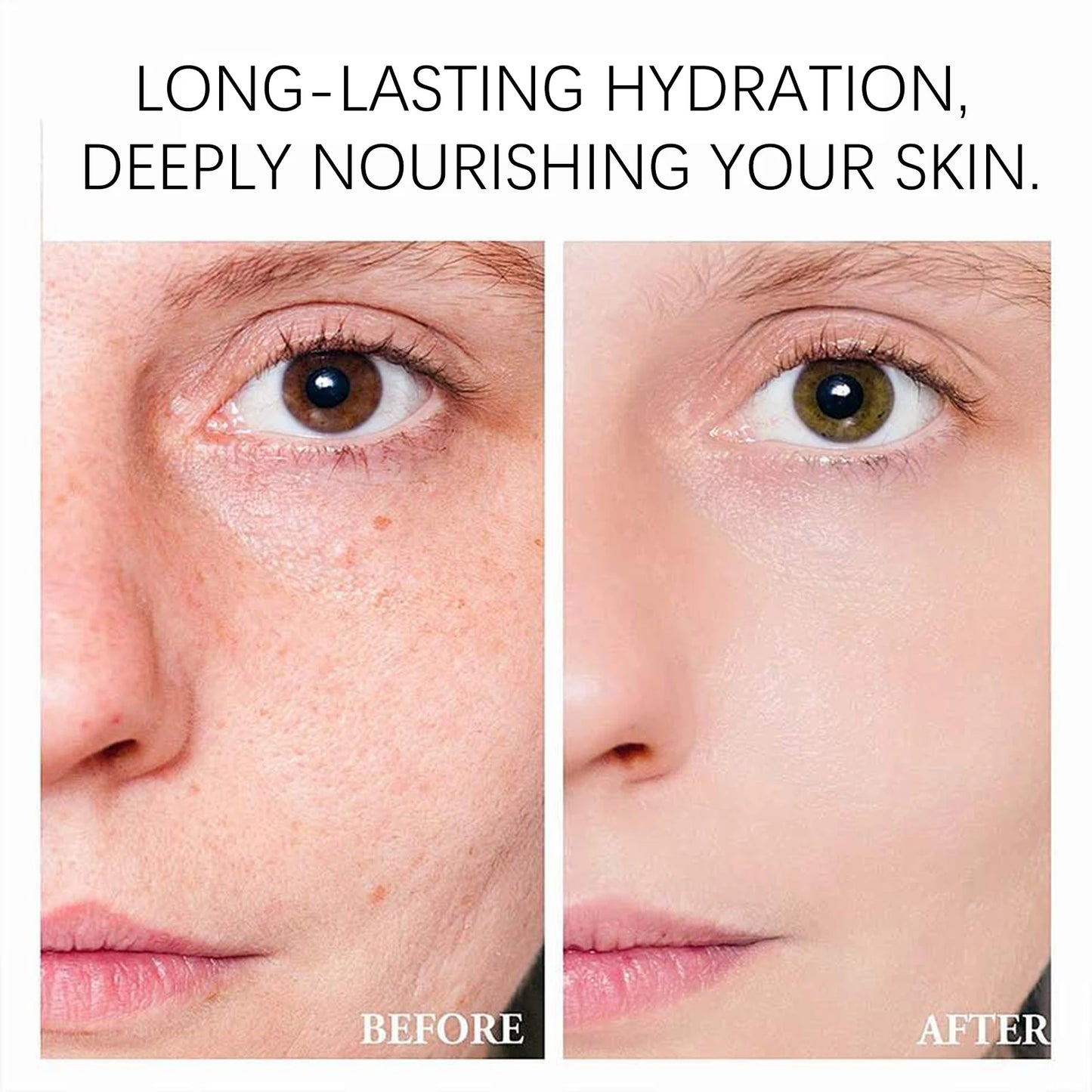 Niacinamide face cream, minimizes pores, moisturizes, suitable for oily skin, effectively hydrates.