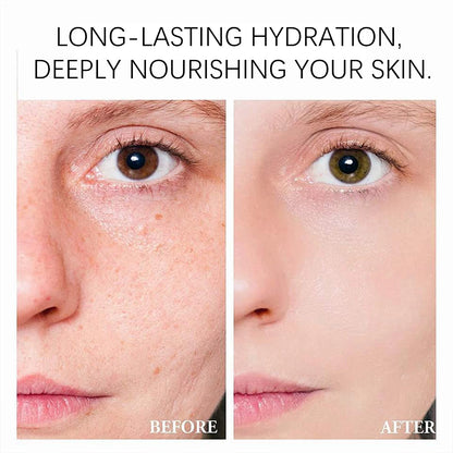 Niacinamide face cream, minimizes pores, moisturizes, suitable for oily skin, effectively hydrates.