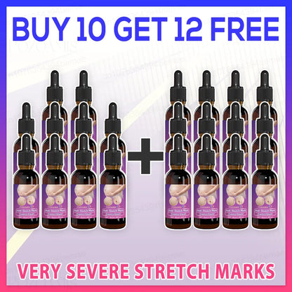 Stretch mark repair, easy removal at home