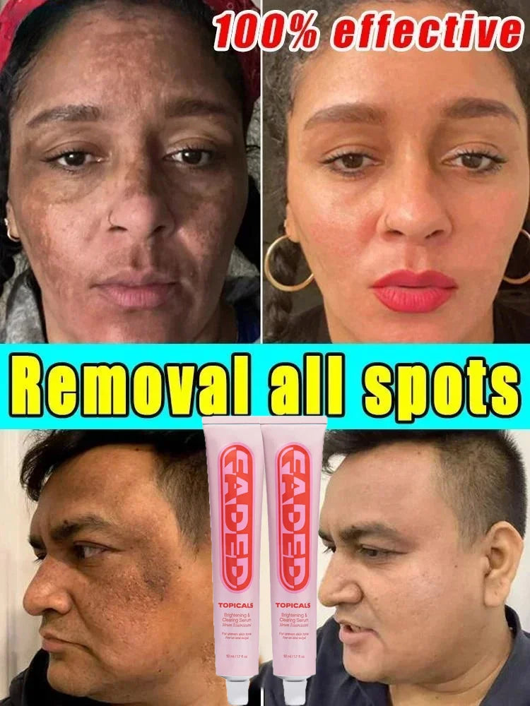 Fade, whiten and clear essence | face cream that can effectively reduce spots and spots