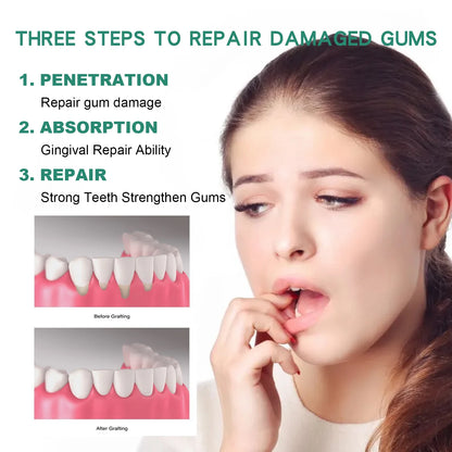 Gingival Repair Drops Quickly Repair of Cavities Caries Teeth Whiten Remove Yellow Plaque Stains Relieve Gums Decay Toothpaste