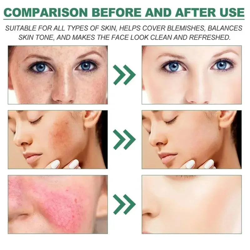 Repair Facial Redness Cream Instant Spider Vein Remove Sensitive Skin Sooth Anti Redness Rosacea Treat Lotion Korean Cosmetics