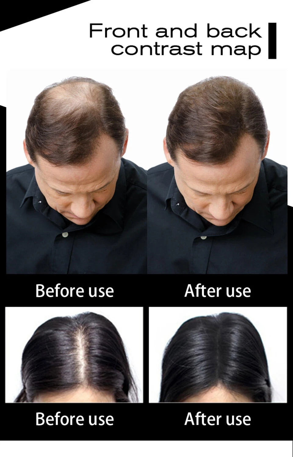 SEVICH 100g Hair Fibers Refill Bag Bald Extension Hair Growth Powder Salon Professional Hair Treatment Unisex Hair Loss Products