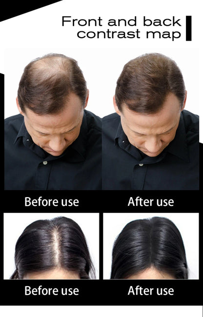SEVICH 100g Hair Fibers Refill Bag Bald Extension Hair Growth Powder Salon Professional Hair Treatment Unisex Hair Loss Products