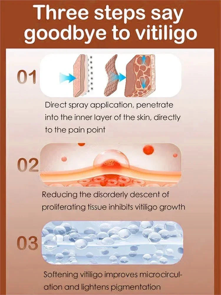 Vitiligo cream, men's and women's skin care essence