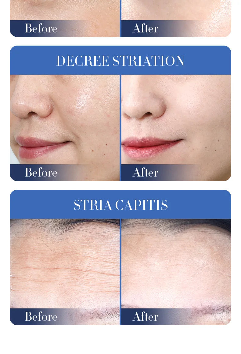 12 Pieces BIOAOUA Bifid Yeast Anti-wrinkle Facial Mask Hydrating Moisturizing Rejuvenation Mask Anti Age Skin Care Wholesale