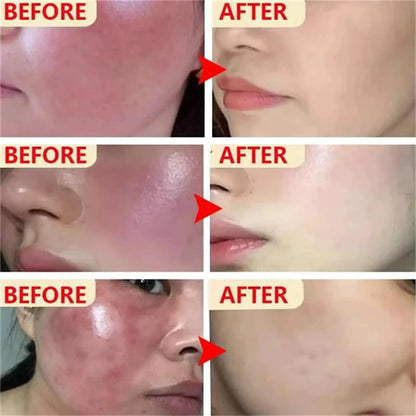 Facial Redness Repair Capsule Oil Improve Sensitive Skin Dryness Moisturizer Soothing Serum Removal Rosacea Korean Cosmetics