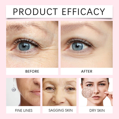Organic Rosehip Oil Improve Fine Lines Wrinkles Firming Lifting Repair Smoothing Shiny Hair Oil Facial Essential Oils Skincare