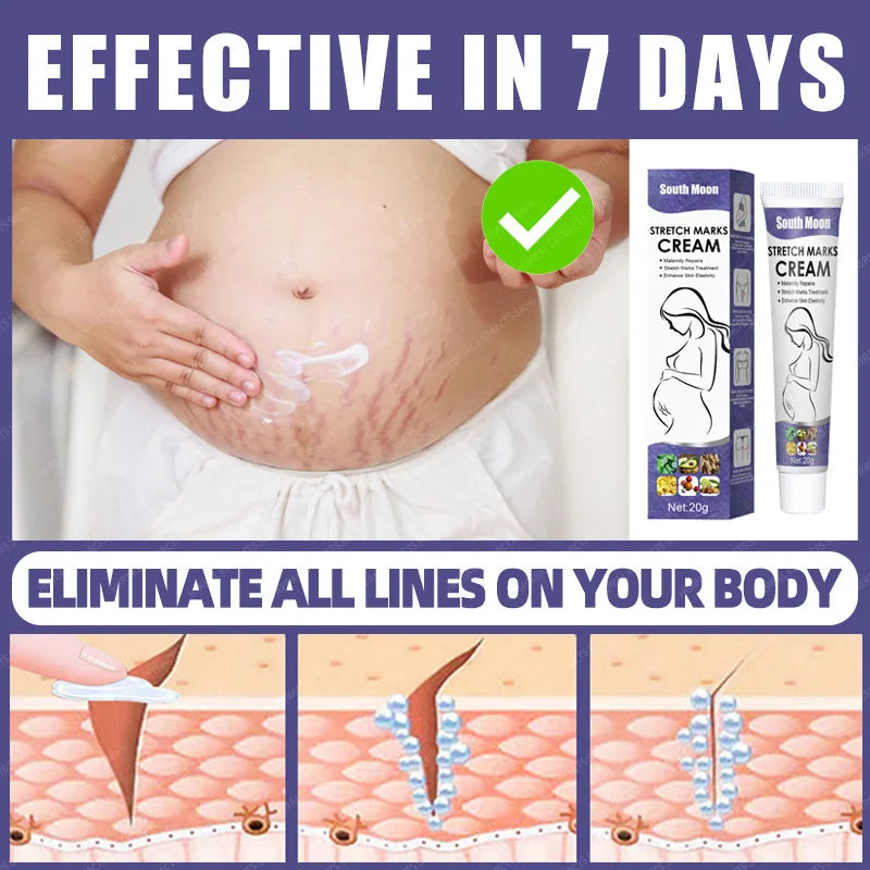 Stretch Mark Repair Cream For Pregnant Women Postpartum Care Firm Light Lines Obesity Lines Growth Lines Repair Cream